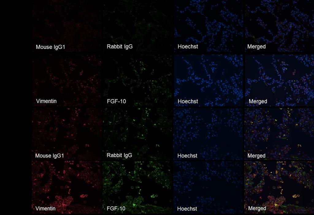 Supplementary Figure S7: Immunofluorescence staining for vimentin and FGF-10 in normal and IPF lungs.