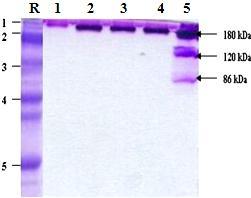 Leuc. mesenteroides 28 9% Gel B A 91% extracellular GTF (%) cell associated GTF (%) Leuc. mesenteroides M2860 Gel C 19% B 81% extracellular GTF (%) cell associated GTF (%) Fig. 3.