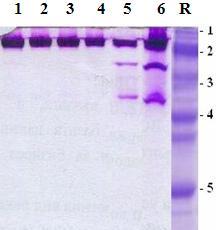 mesenteroides 28 and a mutant strain M2860 To check if the mutant produces different type of GTFs when grown on glucose and sucrose, we separated extracellular and cell-associated proteins of
