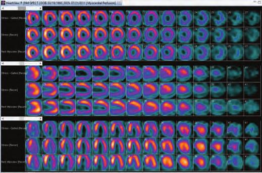 image viewing Remote processing and interpretation of cardiac nuclear studies Reports