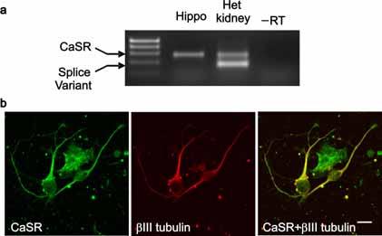 Supplementary Figure 8. CaSR protein is expressed in post-natal hippocampus.