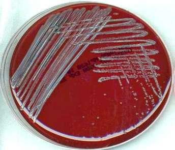 CHROMAGAR STAPH GROWTH: TRYPTIC SOY AGAR GROWTH: DISCUSSION The main purpose of this bacteriological study was to separate and detect the pathogenic microorganisms on the different food types such as