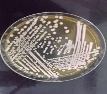 For further confirmation and identification, the culture from the nutrient agar was streaked on different selective media and the presence of pathogenic bacteria ie Staphylococcus aureus was