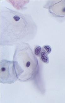However, identification of epithelial cells is nontrivial task due to the complexity nature of pap smears data.