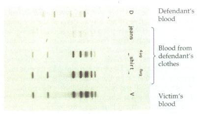 Gel electrophoresis used to look for different number and sizes of