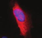 Nuclear DNA was stained with DAPI as shown. Scale bar = 10 µm. (C,D) The HAtagged Siah2 RM protein was coexpressed with or its various mutant forms as indicated.