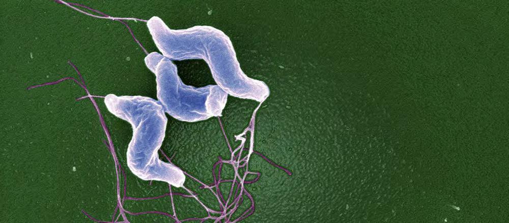 Bacteria: C. jejuni 2016 The Regents of the University of California Image Credit: Science Source This photo shows a few C. jejuni bacteria together in a group. Infections with C.