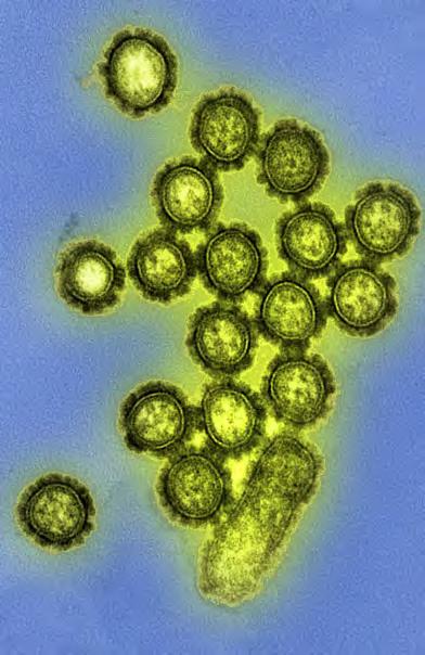 Viruses: On the Edge of Life Oh, no: imagine you woke up this morning with a sore throat, an achy body, and skin that feels like it s burning up. You might have influenza, also known as the flu.