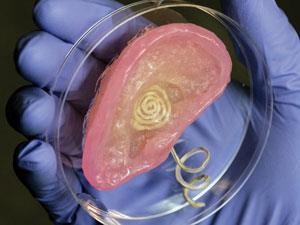 Moving Forward: Functional Organs 3D-printing hydrogels impregnated with living chondrocyte cells those found in
