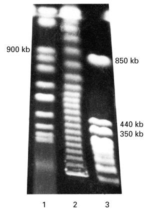 Pulsed-field gel electrophoresis (A) (B) Pulsed-field gel electrophoresis can separate DNA from 20 kb to 10 Mb.