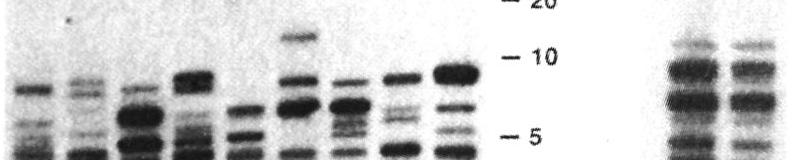 DNA fingerprinting and DNA typing DNA