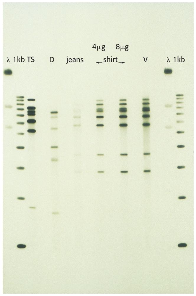 DNA typing in forensics DNA typing is essentially an application of southern blotting.
