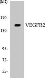 Anti-VEGFR2 Antibody The Anti-VEGFR2 Antibody is a rabbit polyclonal antibody. It was tested on Western Blots for specificity. The data in Figure 4 shows that a single protein band was detected.