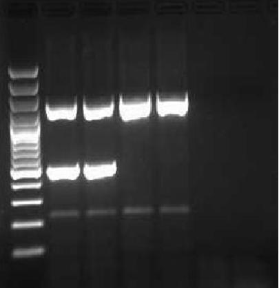 The amplification products were separated by agarose gel electrophoresis on a 1% (w/v) gel (Figure 4).