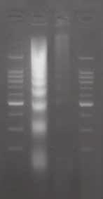 M 1 2 M M : 100 bp DNA Ladder (200 ng) 1 : staurosporine treated 2 : untreated Figure 1 Q5 : A5 : Q6 : A6 : Q7 : Why does electrophoresis show a smear instead of a distinct ladder?