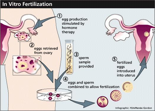 Sources of ES cells In vitro fertilization (IVF): Isolate sperm and egg from male and female, mix together fertilized egg (zygote)