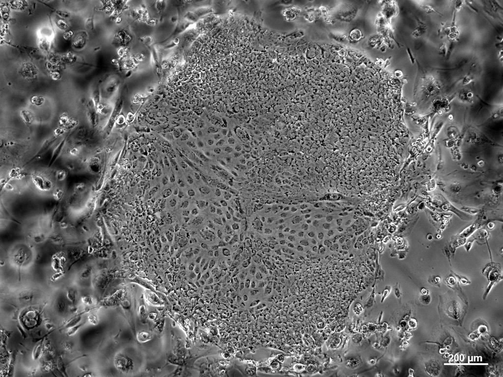 Human embryonic stem cell