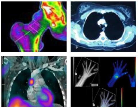 Ionising Radiation in Medicine 2 million doses made each year 1 in 2 Australians will have a nuclear medicine scan in their lifetime Diagnostic and therapeutic applications Diagnosis