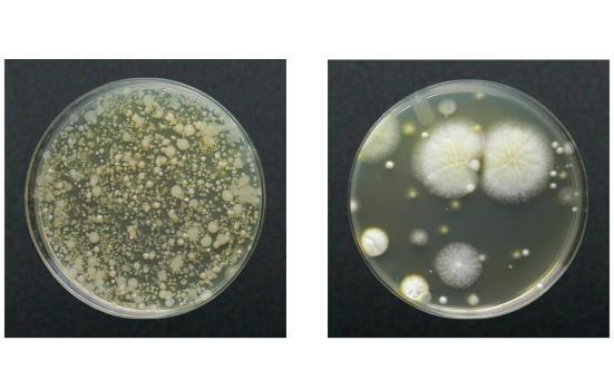 Bacterial colonies selective medium Fungal
