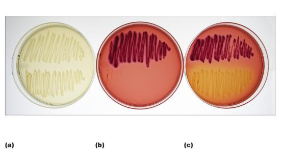 15 The use of MacConkey agar as a selective and differential medium.