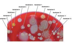 from single parent cell Figure 6.8 Characteristics of bacterial colonies.