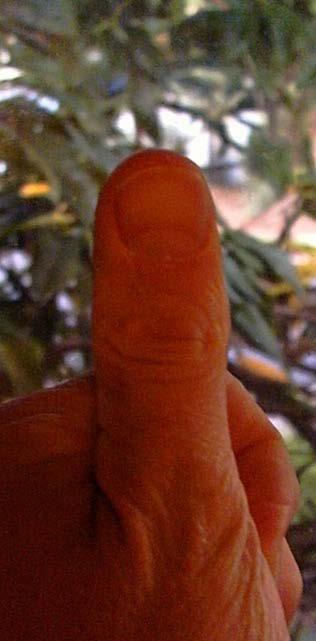 APPROXIMATE BASAL AREA WITH YOUR THUMB!