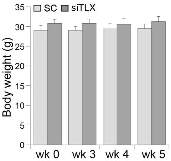 Supplementary Fig. 6 Weight analysis of TLX sirna nanocomplex-treated mice.