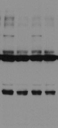 (Left panels) Nuclear extracts (~ 0 µg protein per lane) from two wild-type mouse livers were analyzed in western blots using αhes6 antibody (:000 dilution) in the absence