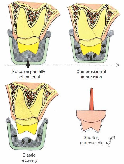 Figure (4-12): Top left, impression tray containing elastomeric impression is seated too late as elasticity starts to develop.