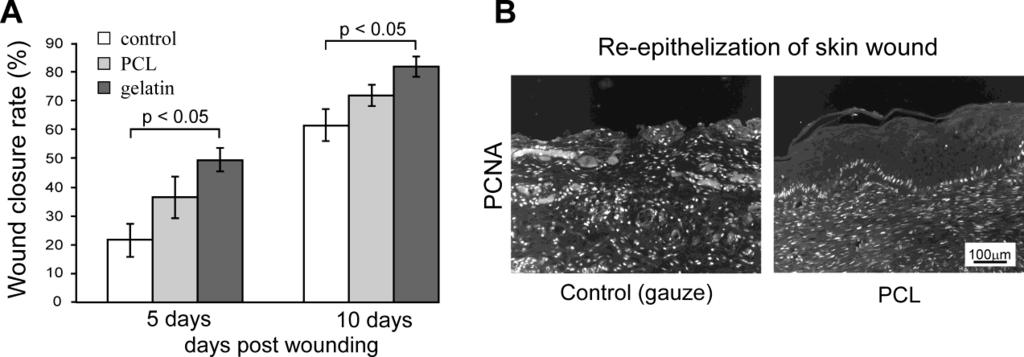 2.4. Nanofibers as wound dressings The efficacy of gelatin and PCL as scaffolds in wound healing was examined using a full thickness wound healing test on rats.