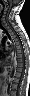 clinical capabilities Single-scan total spine