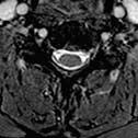 Excellent contrast axial C-spine imaging using