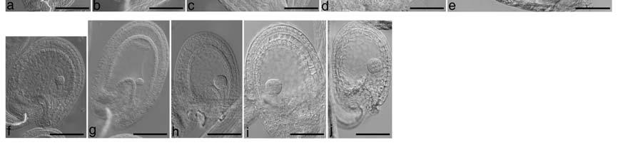 (C) Comparison of embryo development in the hemb1-1 mutant.