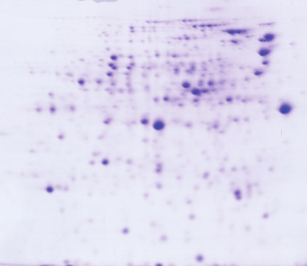 The blot was subjected to a Casein antibody and then to a HRP-conjugated secondary antibody.