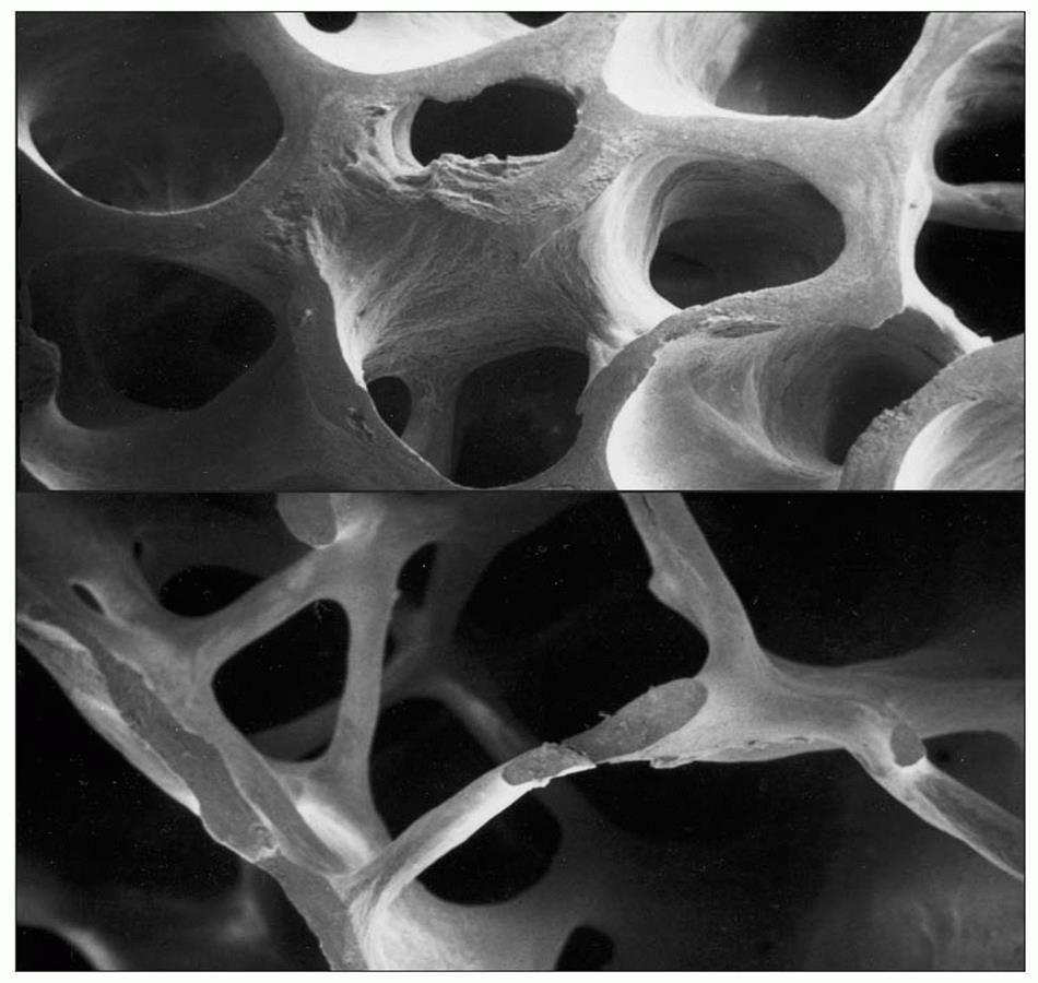 Trabecular bone Mechanical behavior at the continuum level of the whole specimen- the apparent properties as opposed to those at the level of individual trabeculae- the tissue properties For