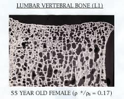 What s the strength of trabecular bone?