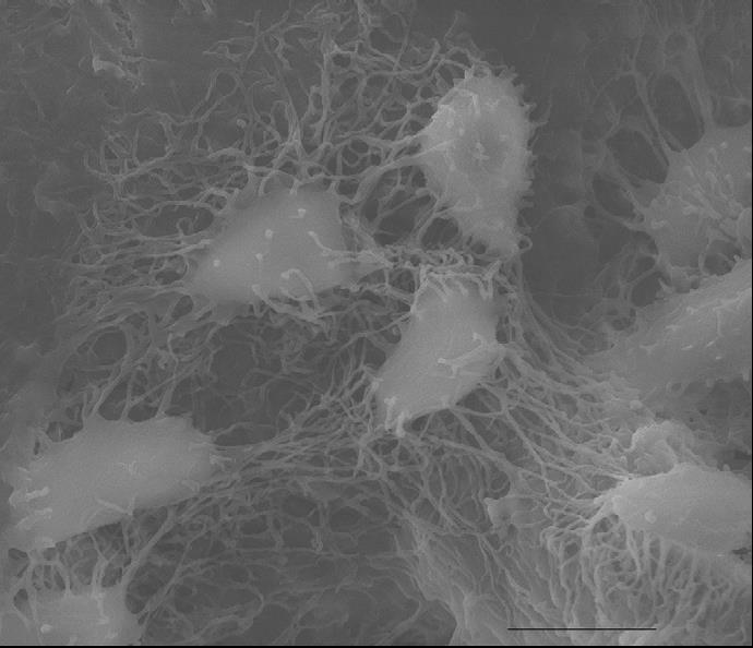 Osteocytes Mechanosenors, most abundant cell type in mature bone (ten times more osteocytes than osteoblasts in normal human bone); Most of