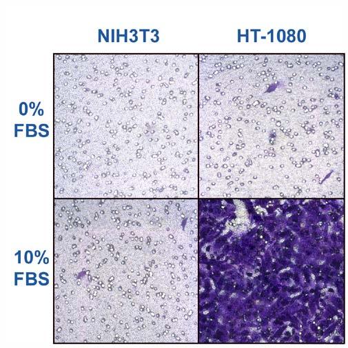 5 0 NIH3T3 HT-1080 Figure 1. Human Fibrosarcoma HT-1080 Laminin Cell Invasion.