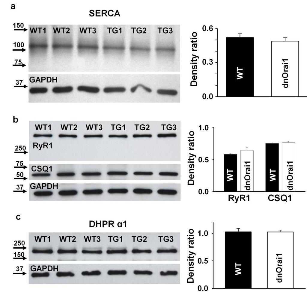 Supplementary Figure S4. Relative SERCA, DHPR 1S, CSQ1 and RyR1 expression are unaltered in dnorai1 transgenic mice.