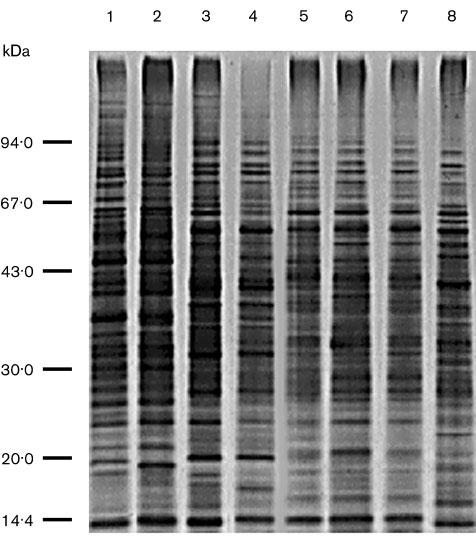 B. La Scola and others Fig. 1. Silver-stained SDS-PAGE image of whole-cell-protein preparations from Bosea spp. Lanes: 1, B. massiliensis 63287 T ;2,B. massiliensis 34649; 3, B. eneae 34614 T ;4,B.