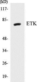 Anti-ETK Antibody The Anti-ETK Antibody is a rabbit polyclonal antibody. It was tested on Western Blots for specificity. The data in Figure 4 shows that a single protein band was detected.