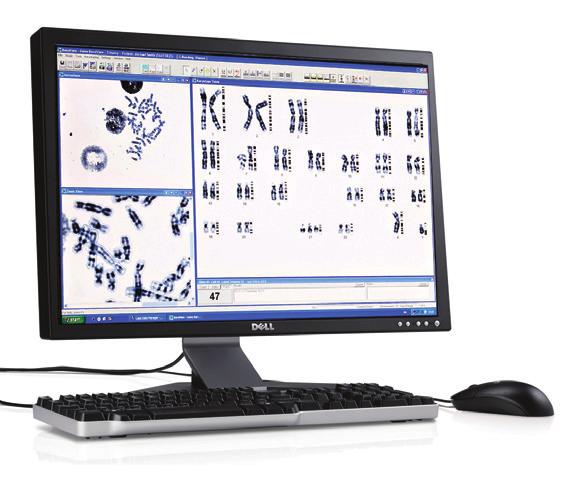 The Complete Platform The GenASIs TM Cytogenetics Suite is the most complete and effective solution available today for karyotype and FISH analysis.