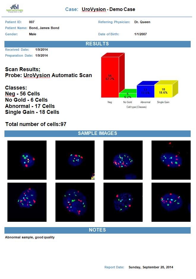 CDM supports cytogenetic labs by displaying case information with its corresponding slides and cells images.