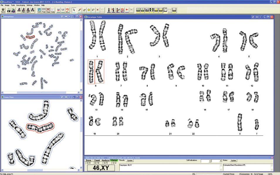 GenASIs BandView GenASIs BandView, ASI s karyotyping application, is designed to save time without compromising results in a true paperless environment.