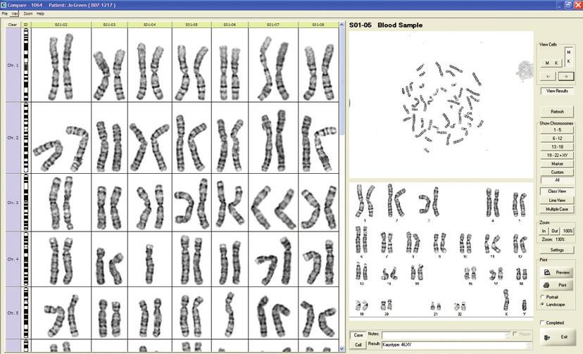 The unique, all-in-one Magic Tool streamlines the karyotyping process by eliminating the need for switching between tools, saving hundreds of mouse clicks per karyotype.