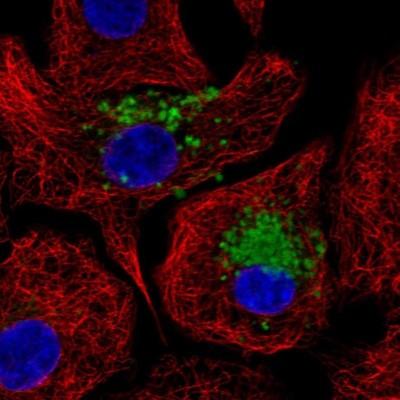 Images Immunocytochemistry/Immunofluorescence: MUC5B Antibody [NBP1-92151] - Staining of