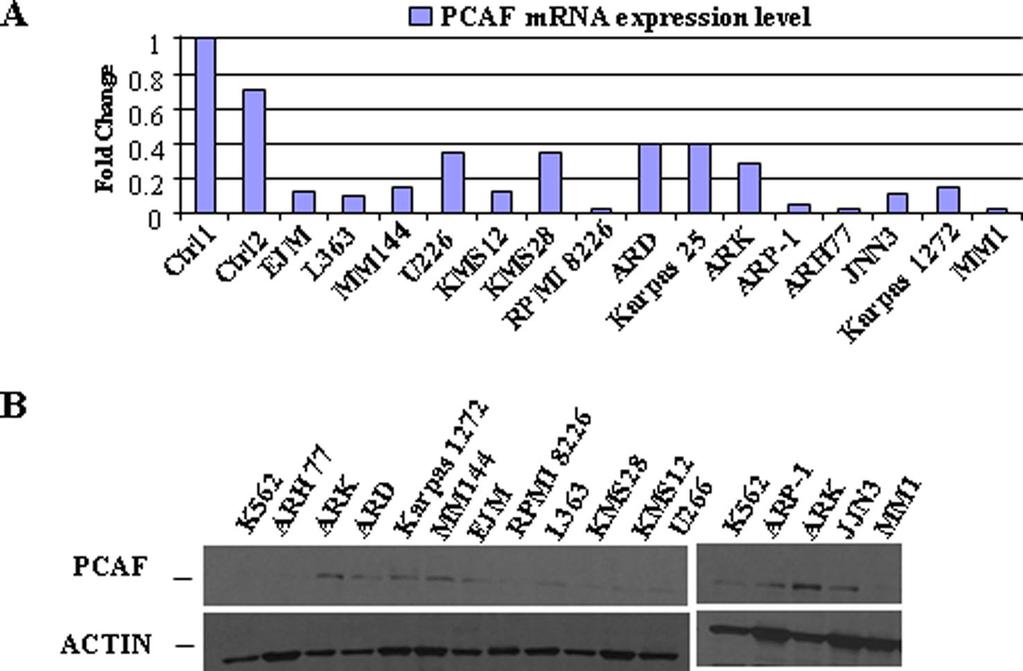 Fig. S3. PCAF expression in MM cell lines. (A) Real-time RT-PCR analyses for PCAF expression in 15 MM cell lines and 1 healthy CD138 PC sample.