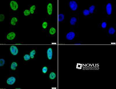 Immunocytochemistry/Immunofluorescence: Histone H3 [Trimethyl Lys4] Antibody [NB21-1023] - Histone H3 K4me3 antibody tested in HeLa cells with FITC (green).