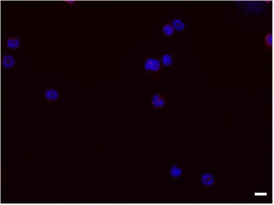 Immunofluorescence staining of Rb in splenocytes.