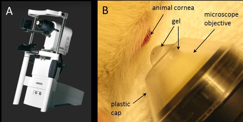 Laser-Scanning in vivo confocal
